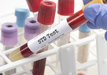 U.S. STD Cases Spiked During Pandemic