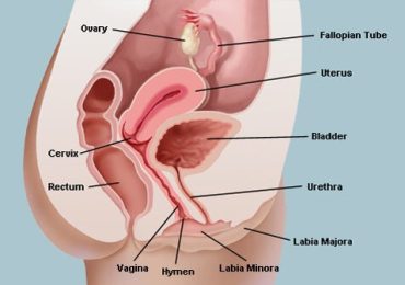 Vaginitis (Inflammation of the Vagina)