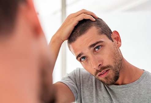 What is the best male hair loss treatment?