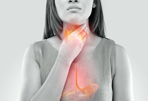 When Should You Worry About Heartburn?
