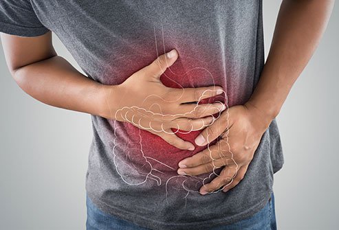 Is Crohn's Disease Contagious?