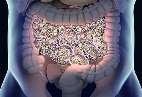  Picture of SIBO (Small Intestinal Bacterial Overgrowth) 